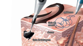 【医師監修】アトピー肌でもタトゥーは入れられる?リスクと注意点を解説