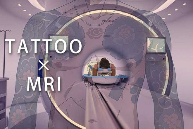 タトゥーがあってもMRI検査は可能？実際はどうなのか検証しました！