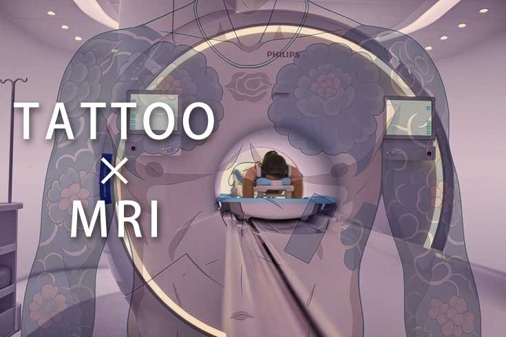 タトゥーがあってもMRI検査は可能？実際はどうなのか検証しました！